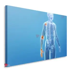 Fisioterapia Horizontal Fsh4