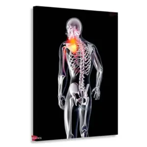 Fisioterapia Vertical Fsv2