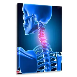 Fisioterapia Vertical Fsv6