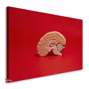 Neurología Horizontal Ngh7